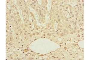 Immunohistochemistry of paraffin-embedded human adrenal gland tissue using ABIN7172122 at dilution of 1:100 (DTYMK 抗体  (AA 1-212))
