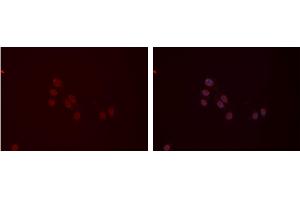 ABIN6277410 staining Hela cells by IF/ICC. (MYL9 抗体  (N-Term))