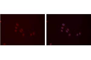 ABIN6277410 staining Hela cells by IF/ICC. (MYL9 抗体  (N-Term))