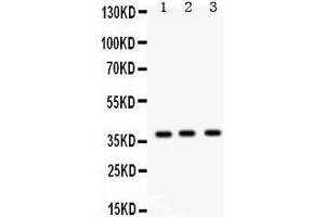 Western Blotting (WB) image for anti-Surfactant Protein D (SFTPD) (AA 292-321), (C-Term) antibody (ABIN3043335) (SFTPD 抗体  (C-Term))
