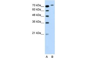 WB Suggested Anti-RHOBTB1 Antibody Titration:  0. (RHOBTB1 抗体  (Middle Region))