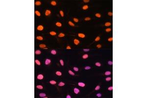 Immunofluorescence (IF) image for anti-Zinc Finger, BED-Type Containing 1 (ZBED1) (AA 1-280) antibody (ABIN6150363)