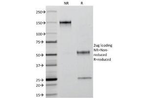 SDS-PAGE Analysis of Purified, BSA-Free Keratin 18 Antibody (clone C-04 or Ks18. (Cytokeratin 18 抗体)