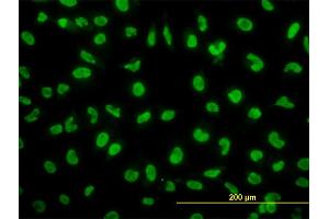 Immunofluorescence of monoclonal antibody to SNAI2 on HeLa cell. (SLUG 抗体  (AA 97-169))
