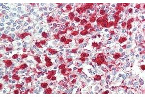 Detection of ITGb6 in Human Spleen Tissue using Polyclonal Antibody to Integrin Beta 6 (ITGb6) (ITGB6 抗体  (AA 131-619))