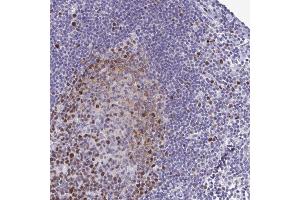 Immunohistochemical staining of human lymph node with IFITM1 polyclonal antibody  shows strong cytoplasmic positivity in lymphoid cells outside reaction centra at 1:200-1:500 dilution. (TIPIN 抗体)