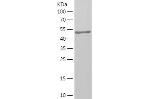 PAPD5 Protein (AA 1-196) (His-IF2DI Tag)
