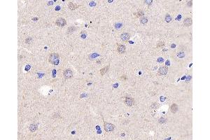 Immunohistochemistry analysis of parafffin-embedded rat brain using P2RX3 Polyclonal Antibody at dilution of 1:400. (P2RX3 抗体)