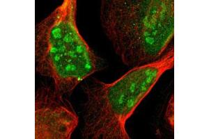 Immunofluorescent staining of U-2 OS with ATP6AP2 polyclonal antibody  (Green) shows positivity in nucleus and nucleoli.