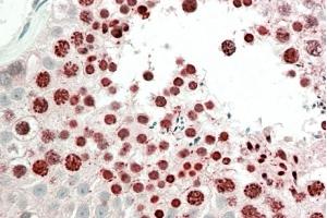 ABIN5868646 (5 µg/ml) staining of paraffin embedded Human Testis. (HOXA10 抗体)