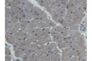#VALUE! (FABP4 抗体  (AA 2-132))