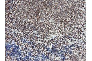 Image no. 5 for anti-Malignant T Cell Amplified Sequence 1 (MCTS1) (AA 1-181) antibody (ABIN1490599) (MCTS1 抗体  (AA 1-181))