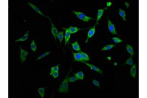 Immunofluorescence staining of NIH/3T3 cells with ABIN7143720 at 1:166, counter-stained with DAPI. (AGPS 抗体  (AA 279-400))