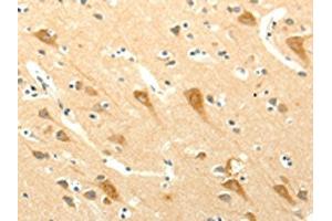 The image on the left is immunohistochemistry of paraffin-embedded Human brain tissue using ABIN7131272(SYT5 Antibody) at dilution 1/15, on the right is treated with fusion protein. (Synaptotagmin V 抗体)
