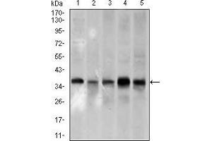 Western blot analysis using PCNA mouse mAb against A431 (1), HeLa (2), HepG2 (3), Raji (4), and MOLT4 (5) cell lysate. (PCNA 抗体  (AA 53-196))