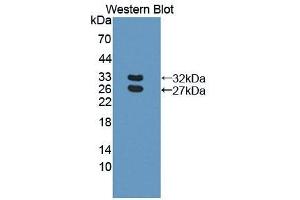 Detection of Recombinant BCAM, Human using Polyclonal Antibody to Basal Cell Adhesion Molecule (BCAM) (BCAM 抗体  (AA 32-257))