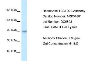 WB Suggested Anti-TBC1D2B Antibody   Titration: 1.