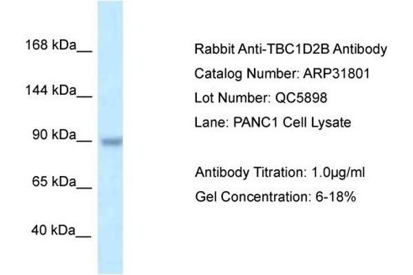 TBC1D2B anticorps  (C-Term)