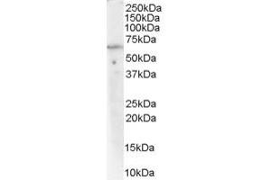 Western Blotting (WB) image for anti-Protein Phosphatase 2, Regulatory Subunit A, alpha (PPP2R1A) (C-Term) antibody (ABIN2465278) (PPP2R1A 抗体  (C-Term))