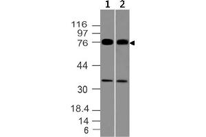 Image no. 1 for anti-Melanoma Associated Antigen (Mutated) 1 (MUM1) (AA 52-278) antibody (ABIN5027377) (MUM1 抗体  (AA 52-278))