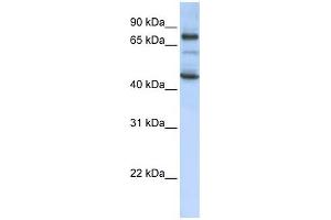 GAS2L1 antibody used at 1 ug/ml to detect target protein. (GAS2L1 抗体  (Middle Region))