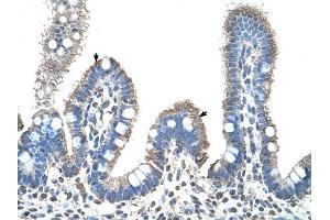 SLC22A1 antibody was used for immunohistochemistry at a concentration of 4-8 ug/ml to stain Epithelial cells of intestinal villus (arrows) in Human Intestine. (SLC22A1 抗体)