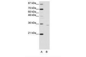 Image no. 1 for anti-Orthopedia Homeobox (OTP) (C-Term) antibody (ABIN6736160) (OTP 抗体  (C-Term))