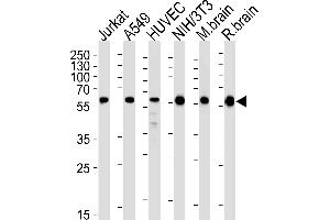 Western blot analysis of lysates from Jurkat, A549, HUVEC, mouse NIH/3T3 cell line and mouse brain, rat brain tissue lysates (from left to right), using RAD23B Antibody (N-term) (ABIN1944896 and ABIN2843646). (RAD23B 抗体  (N-Term))
