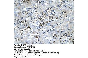 Human Liver (SCD 抗体  (Middle Region))