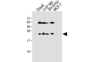 All lanes : Anti-PRL Antibody (Center) at 1:1000 dilution Lane 1: Daudi whole cell lysate Lane 2: U-87 MG whole cell lysate Lane 3: SH-SY5Y whole cell lysate Lane 4: MCF-7 whole cell lysate Lysates/proteins at 20 μg per lane. (Prolactin 抗体  (AA 48-76))