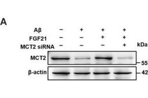 Western Blotting (WB) image for anti-Solute Carrier Family 16, Member 7 (Monocarboxylic Acid Transporter 2) (SLC16A7) (C-Term) antibody (ABIN6147861)