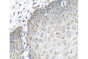 Immunohistochemistry of paraffin-embedded Human esophagus using TMOD3 Polyclonal Antibody at dilution of 1:100 (40x lens). (TMOD3 抗体)