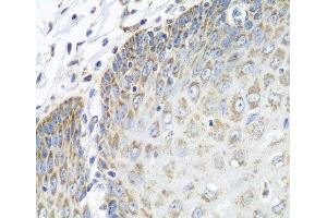 Immunohistochemistry of paraffin-embedded Human esophagus using TMOD3 Polyclonal Antibody at dilution of 1:100 (40x lens). (TMOD3 抗体)