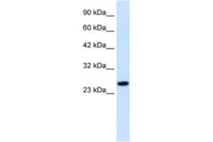 Western Blotting (WB) image for anti-Regulator of G-Protein Signaling 13 (RGS13) antibody (ABIN2460853) (RGS13 抗体)
