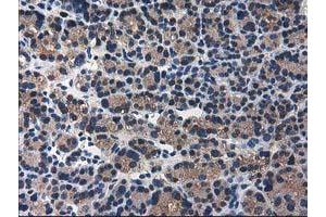 Image no. 13 for anti-ADP-Ribosylation Factor GTPase Activating Protein 1 (ARFGAP1) antibody (ABIN1496679)