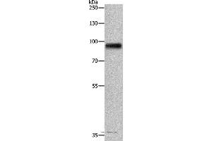 Western blot analysis of Human fetal brain tissue, using APLP1 Polyclonal Antibody at dilution of 1:650 (APLP1 抗体)
