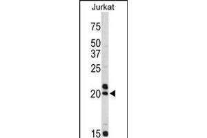 Western blot analysis of VIP antibody in Jurkat cell line lysates (35ug/lane) (Vip 抗体  (C-Term))