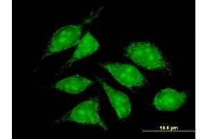Immunofluorescence of purified MaxPab antibody to COX5B on HeLa cell. (COX5B 抗体  (AA 1-129))