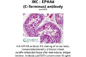 Image no. 2 for anti-EPH Receptor A6 (Epha6) antibody (ABIN1734079) (EPH Receptor A6 抗体)