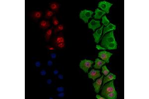 ABIN7093391 and ABIN7097412 staining Hela cells by IF/ICC. (IRF7 抗体)