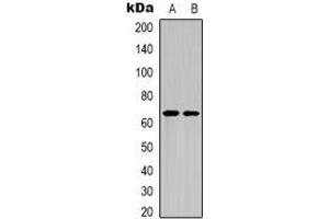 Western blot analysis of NF-kappaB p65 (AcK122) expression in HepG2 UV-treated (A), mouse brain (B) whole cell lysates. (NF-kB p65 抗体  (acLys122))