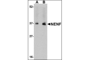 Western blot analysis of NENF in human kidney tissue lysate with this product at (A) 1 and (B) 2 μg/ml. (Neudesin 抗体  (C-Term))