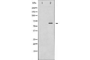 Western blot analysis of SHP-2 expression in A431 whole cell lysates,The lane on the left is treated with the antigen-specific peptide. (PTPN11 抗体  (C-Term))