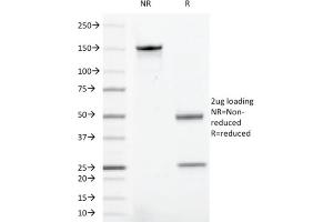 SDS-PAGE Analysis Purified CD43 Mouse Recombinant Monoclonal Antibody (rSPN/1094). (Recombinant CD43 抗体)