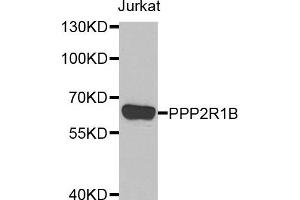 Western blot analysis of extracts of Jurkat cell line, using PPP2R1B antibody. (PPP2R1B 抗体)