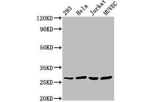 Western Blot Positive WB detected in: 293 whole cell lysate, Hela whole cell lysate, Jurkat whole cell lysate, HUVEC whole cell lysate All lanes: CACYBP antibody at 2. (CACYBP 抗体  (AA 2-228))