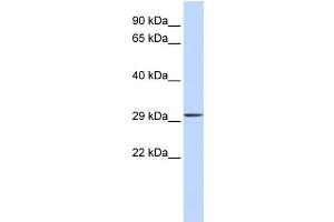 WB Suggested Anti-C1orf111 Antibody Titration:  0.