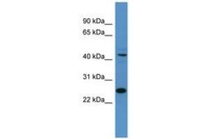 Image no. 1 for anti-Transcription Factor Dp-1 (TFDP1) (AA 21-70) antibody (ABIN6746158) (DP1 抗体  (AA 21-70))