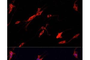Immunofluorescence analysis of PC-12 cells using ENO2 Polyclonal Antibody at dilution of 1:100. (ENO2/NSE 抗体)