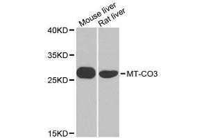 Western blot analysis of extracts of various cell lines, using MT-CO3 antibody. (COX3 抗体  (AA 1-100))